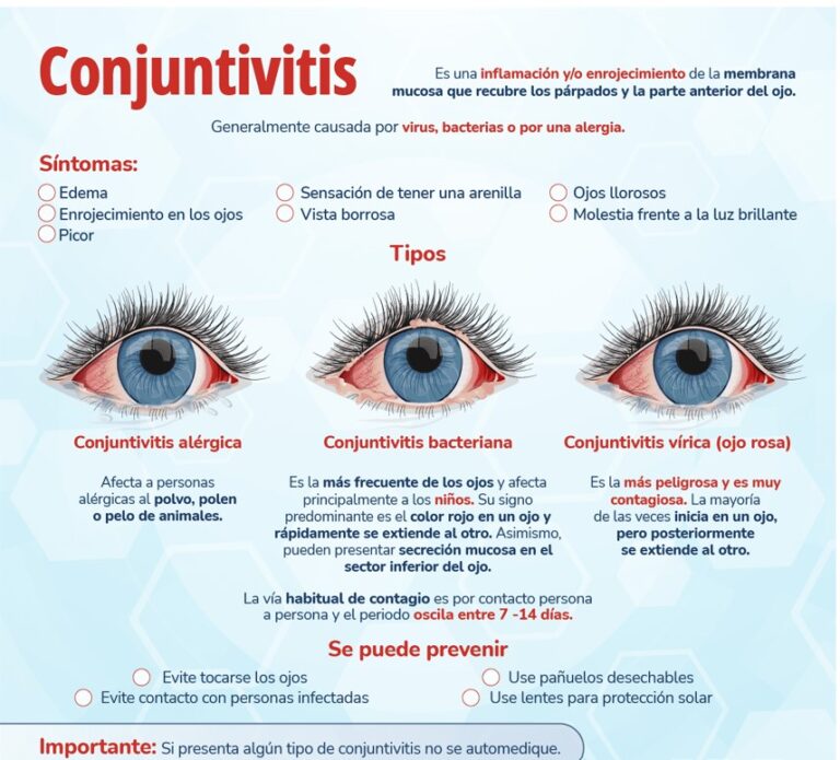 Alerta Ola De Casos De Conjuntivitis Ojo Con Los Niños Funes Hoy